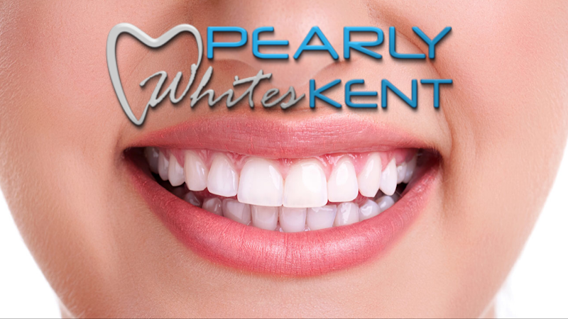Pearly Whites Kent
